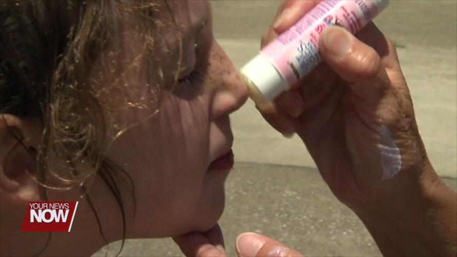 Survey shows less than 1/3rd of teens use sun protection