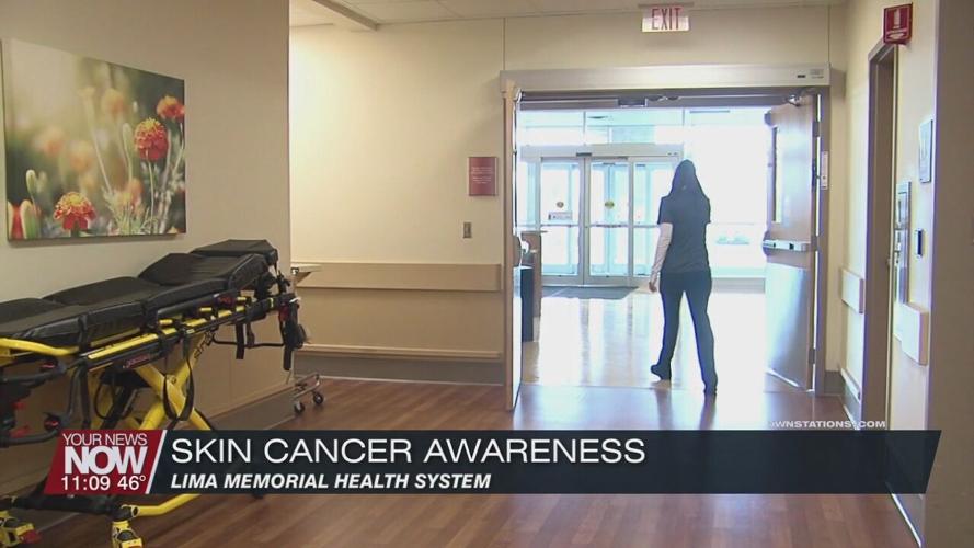 Skin cancer awareness month comes to an end with free screenings