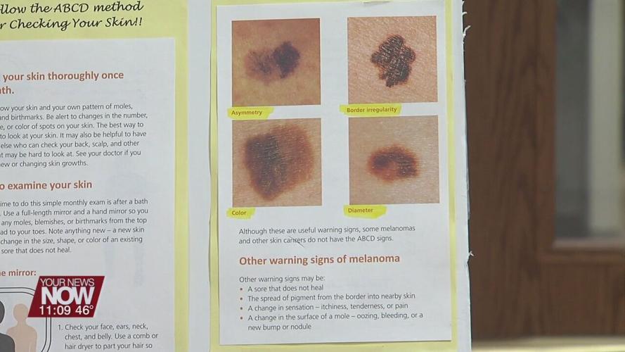 Skin cancer awareness month comes to an end with free screenings