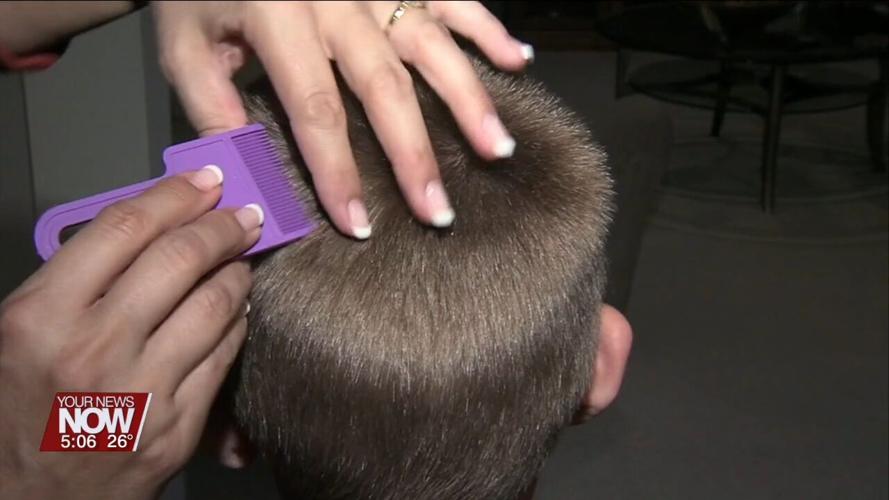 What to do if your child gets lice at school