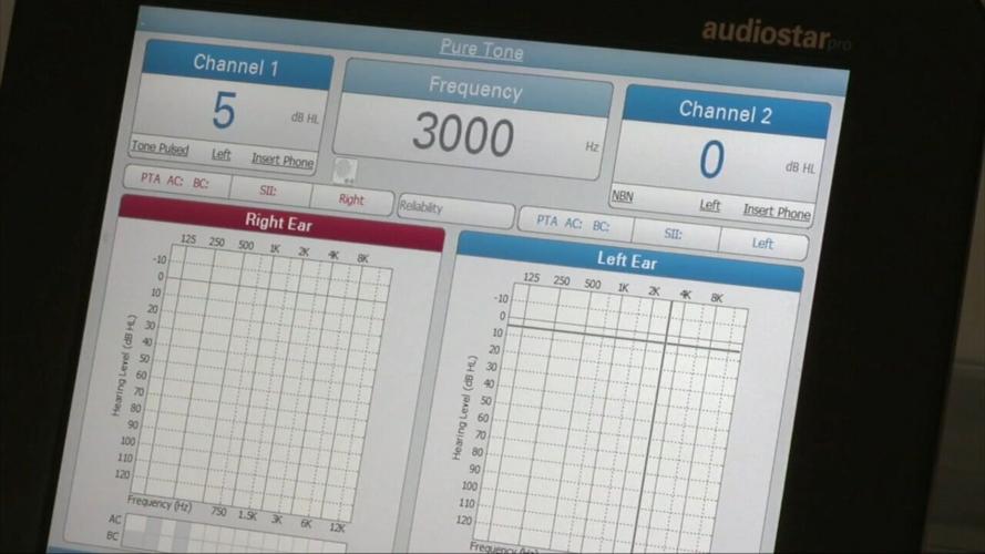 Study highlights lack of awareness with hearing loss