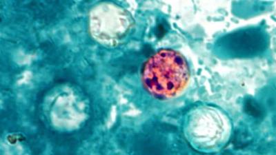 Cyclospora