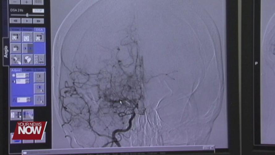 Lima Memorial receives national award for stroke patient care