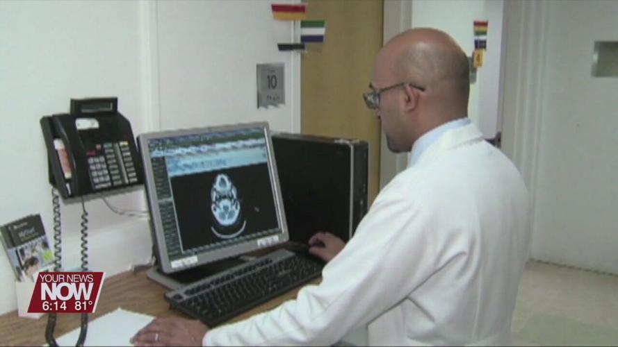 Doctors want you to know the signs of a stroke