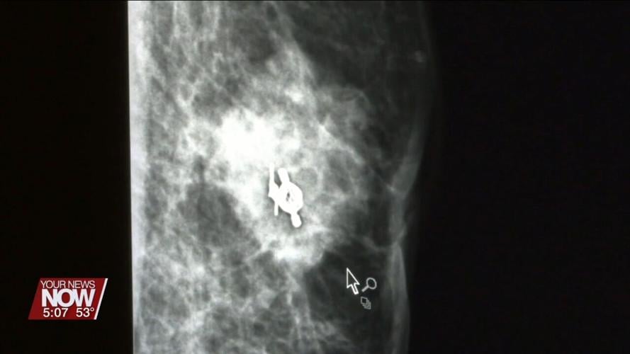 Man discusses his journey after discovering a lump on his chest is breast cancer