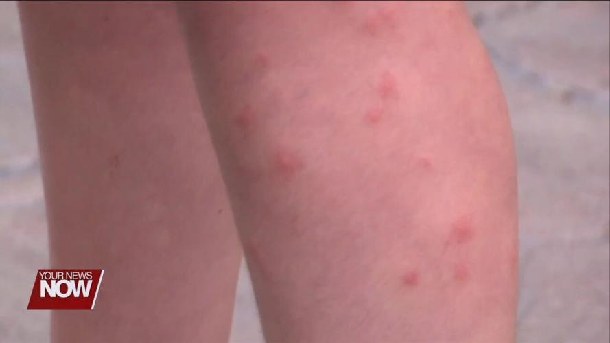 Don’t Let Mosquito-Borne Illness Ruin Summer Travel