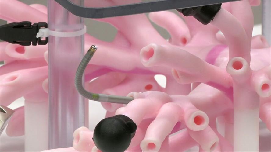 New lung cancer detection technology at Lima Memorial Health System