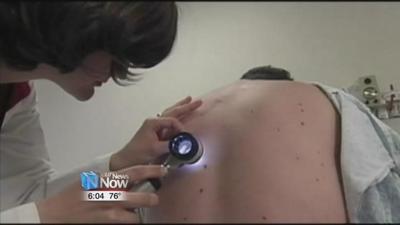 Watching for signs of skin cancer