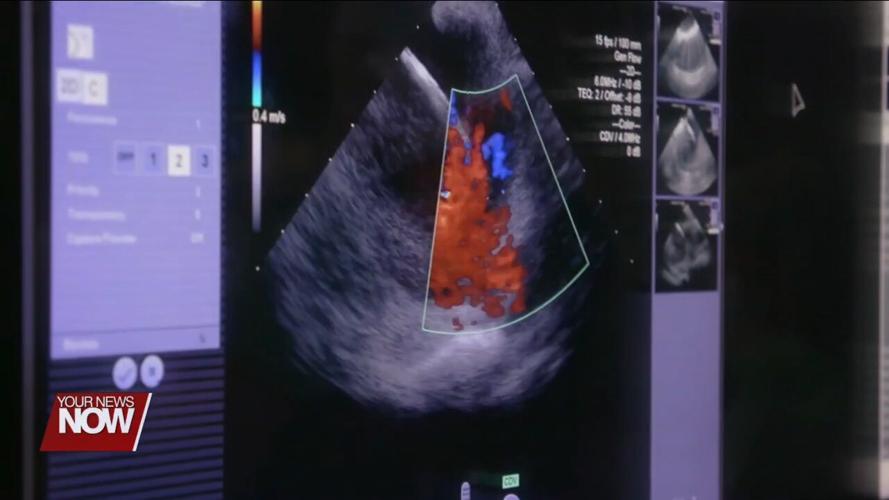New device helps prevent ablation complication