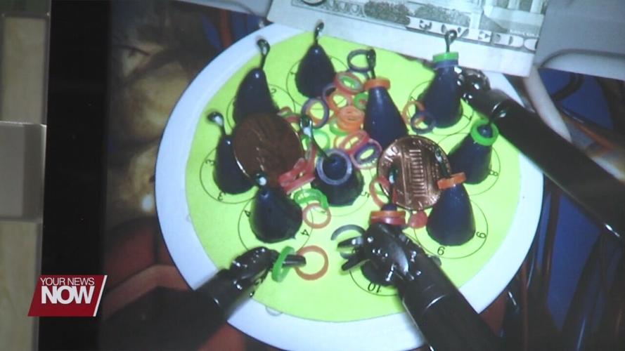 A Lima surgeon performs his 2000th robotic surgery at Lima Memorial Health System