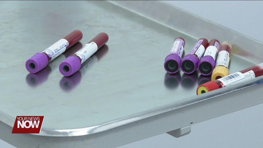 Cleveland Clinic study shows how COVID-19 plays role in risk for long-term cardiac issues