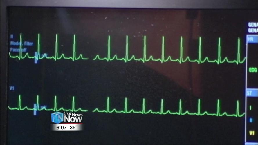 Study shows heart disease on the rise for women under 55 2.jpg