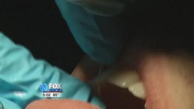 To Floss or Not to Floss