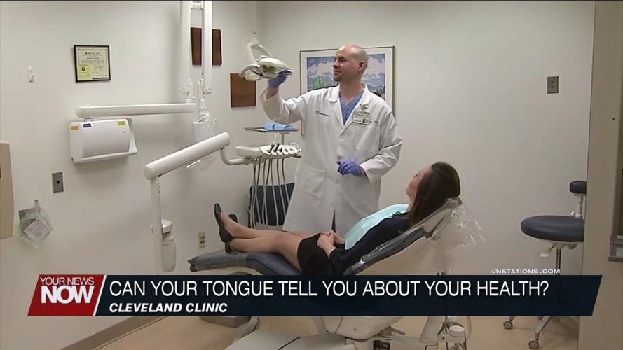 Your tongue can give insight into your health reveals doctor