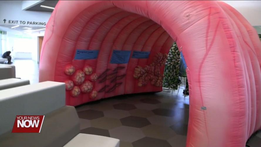Lima Memorial Health System brings in a giant colon to promote  Colorectal Cancer Awareness Month