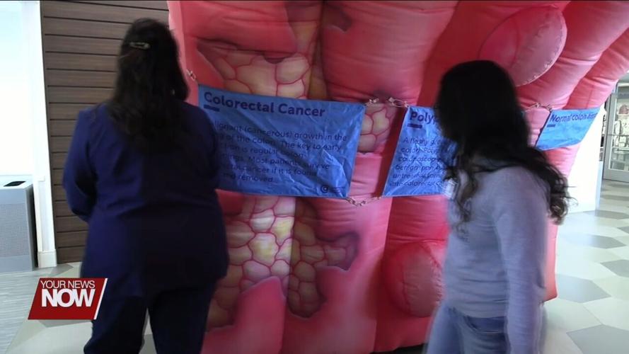 Lima Memorial Health System brings in a giant colon to promote  Colorectal Cancer Awareness Month