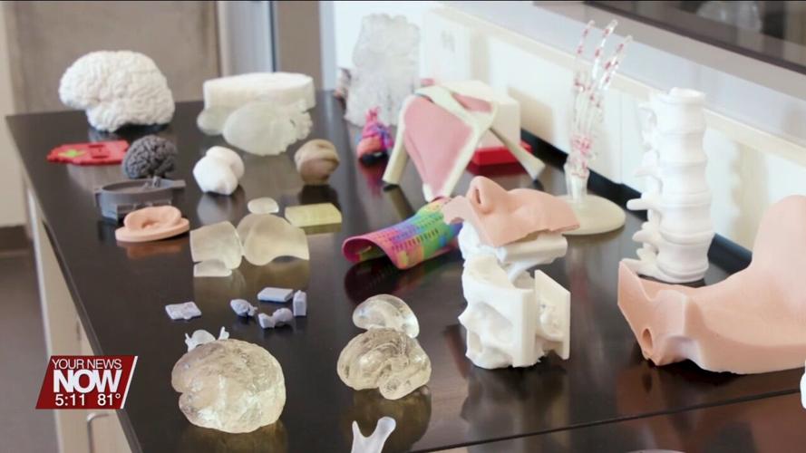 3D technology helps with cancer treatments