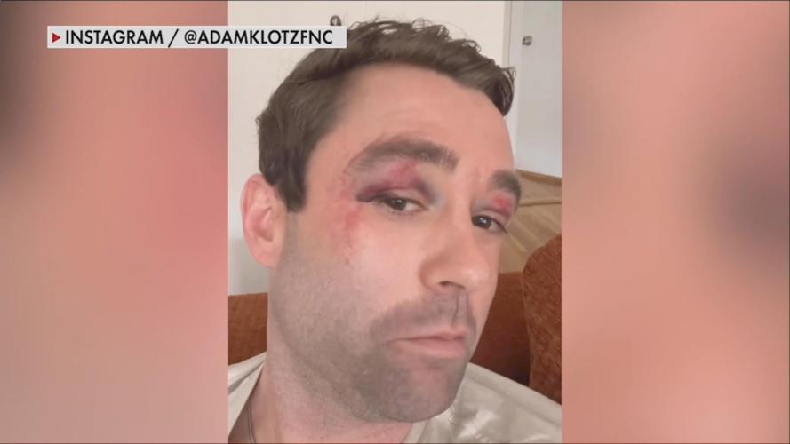 Former Your Hometown Stations morning meteorologist attacked by teens in New York after defending another man being harassed