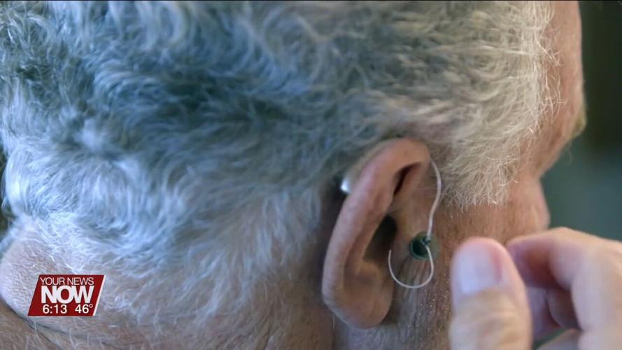 Study shows a link on how hearing loss is linked to cognitive decline