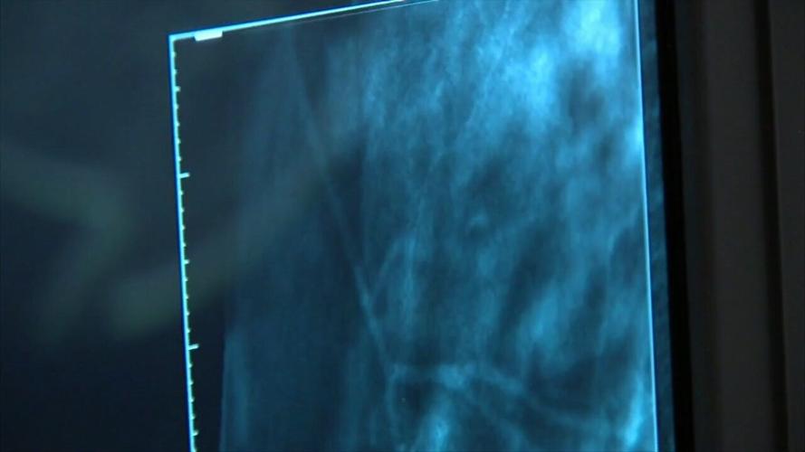 Mercy Health-St. Rita's promoting early breast cancer detection with 5K