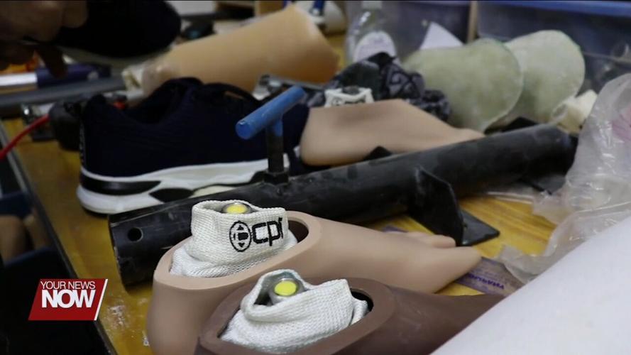 Project Elevenfive providing prosthetic care to individuals in underserved areas of the world