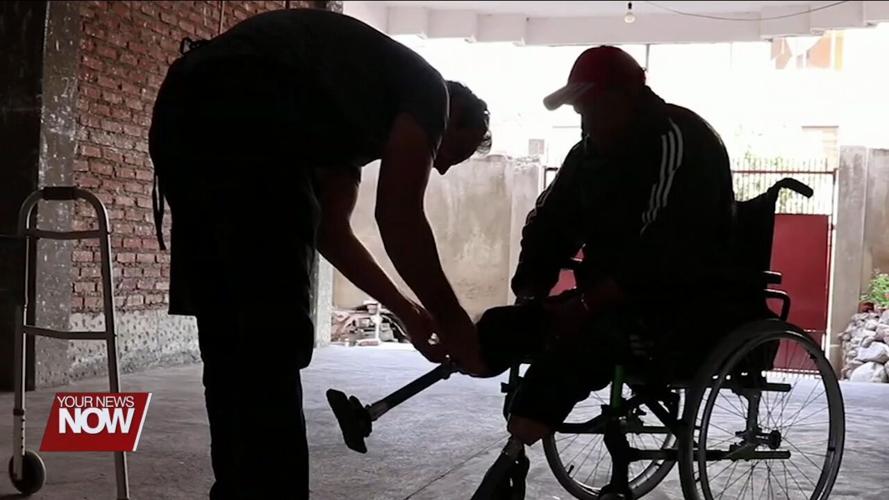 Project Elevenfive providing prosthetic care to individuals in underserved areas of the world