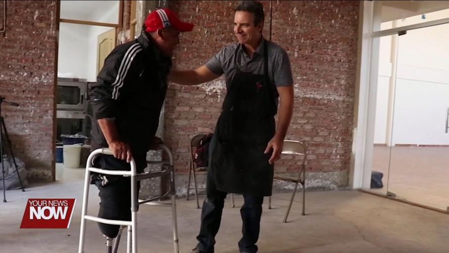 Project Elevenfive providing prosthetic care to individuals in underserved areas of the world