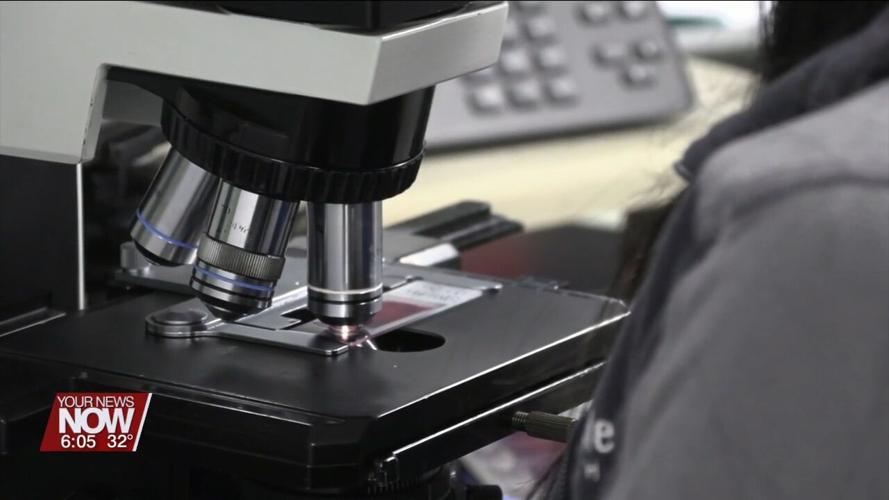 Lima Memorial Health System is now offering Direct Access Testing for patients