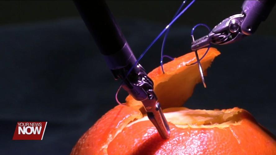 Mercy Health-St. Rita's celebrates its 10,000th robotic procedure