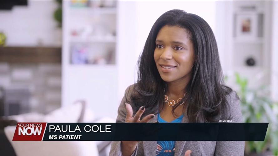 Uncovering why more Black women than ever are being diagnosed with multiple sclerosis