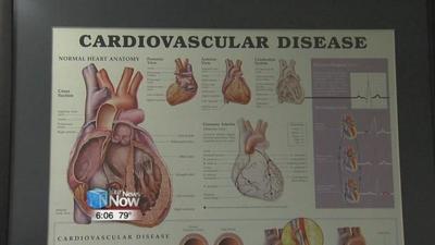New aortic valve replacement at Mercy Health St. Rita's