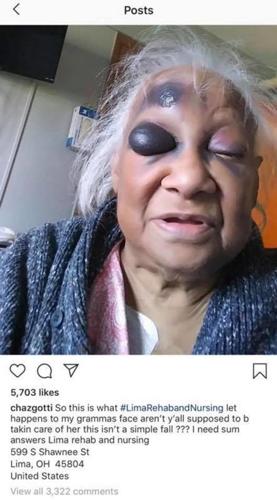 Elderly Woman Investigation at Lima Rehab.jpg