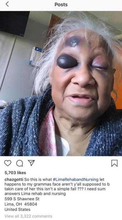 Elderly Woman Investigation at Lima Rehab.jpg