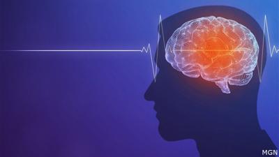 Stroke Generic