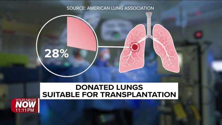 Superhero team delivers a second chance at life with double lung transplant