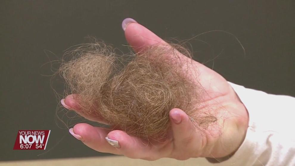 Experiencing hair loss after COVID recovery News