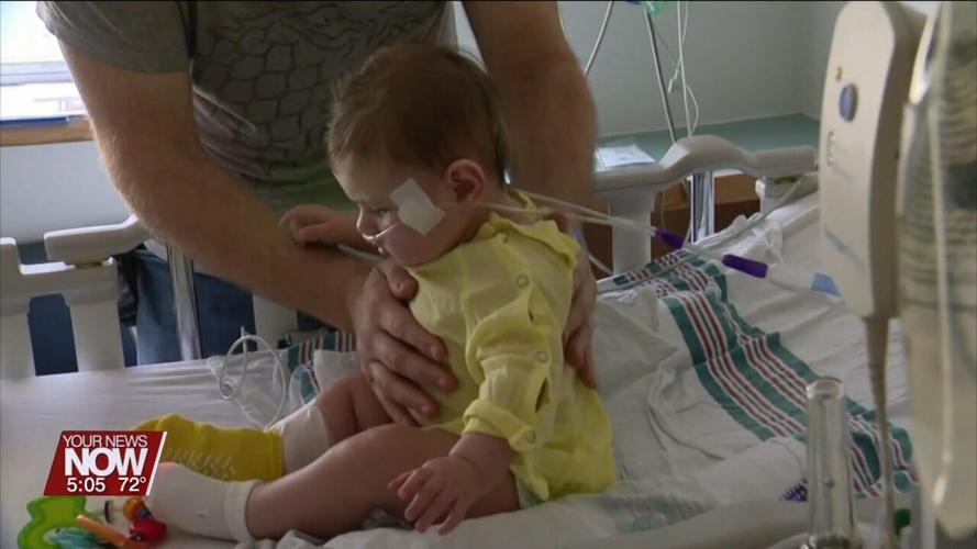 Doctors are concerned about the greater numbers of RSV cases they are seeing this year