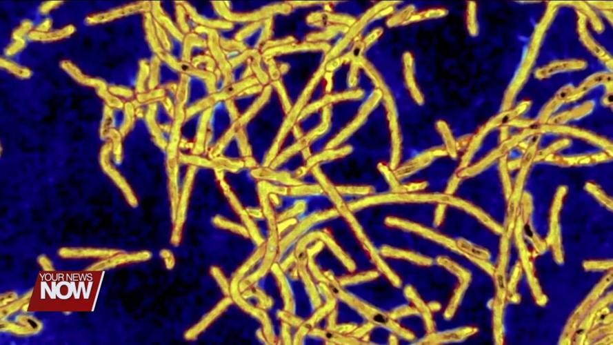 Two cases of Legionnaires' disease confirmed in Allen County