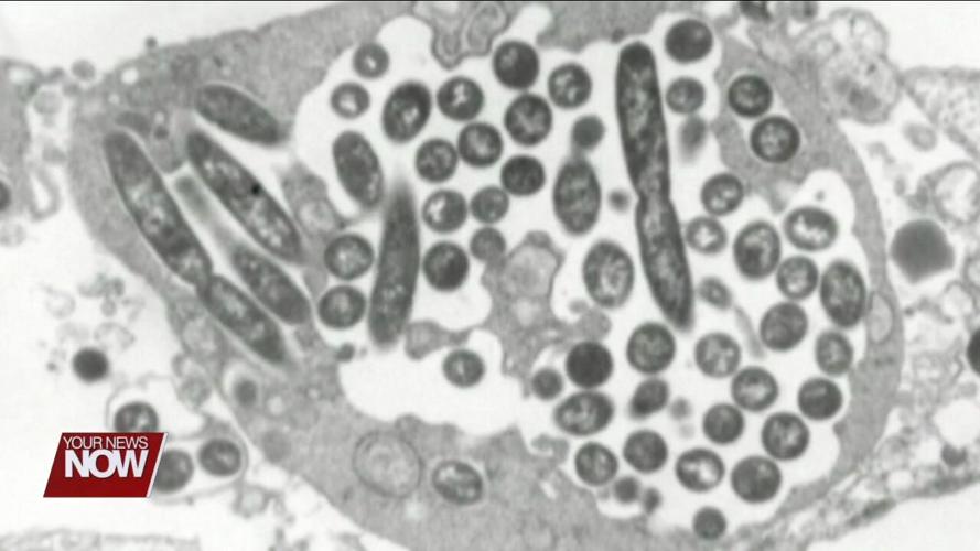 Two cases of Legionnaires' disease confirmed in Allen County