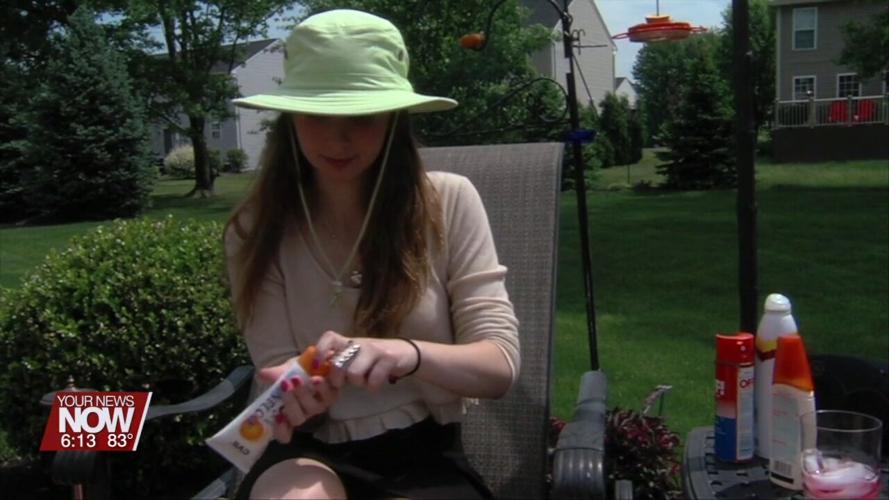 Spending time in the sun can be good for eczema or psoriasis, but doctors say don't overdo it