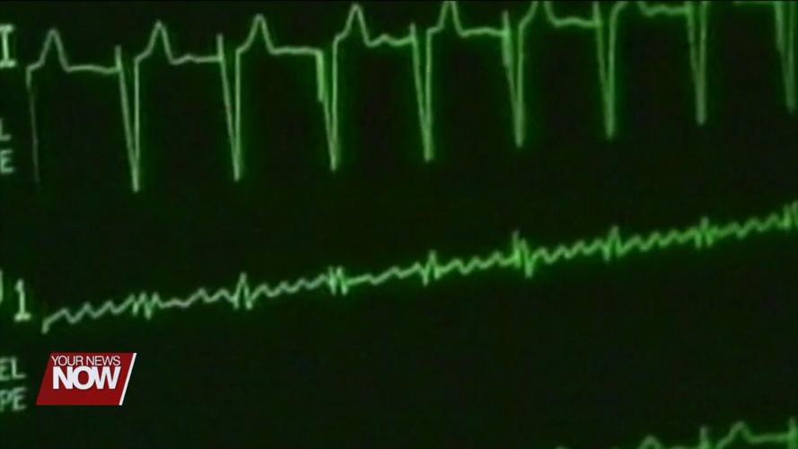 Care Access is looking for volunteers to take part in a Lipoprotein(a) study