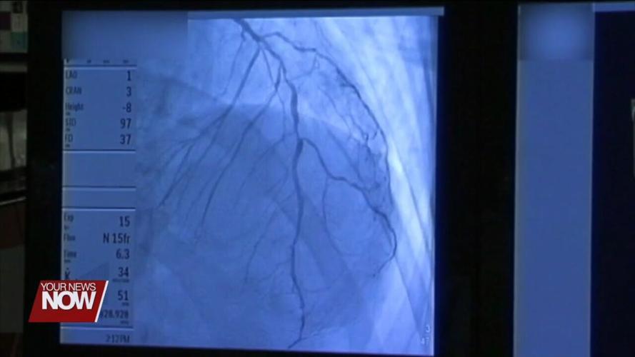 Care Access is looking for volunteers to take part in a Lipoprotein(a) study