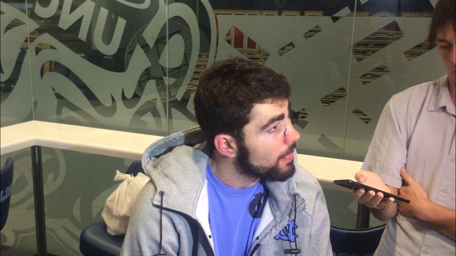 Luke Maye nose 2
