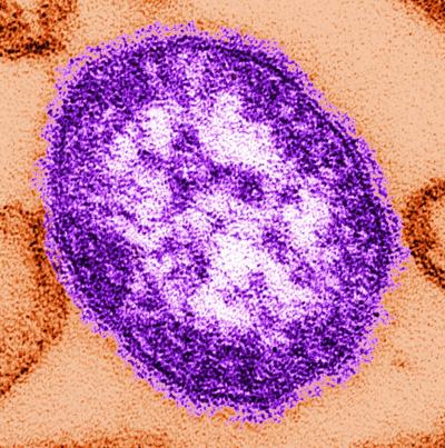 Washington Post: Measles is more contagious than the coronavirus. And it’s back.