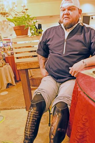 020122-hdr-news-transplant-p1