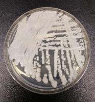 Superbug fungus cases rose dramatically during pandemic
