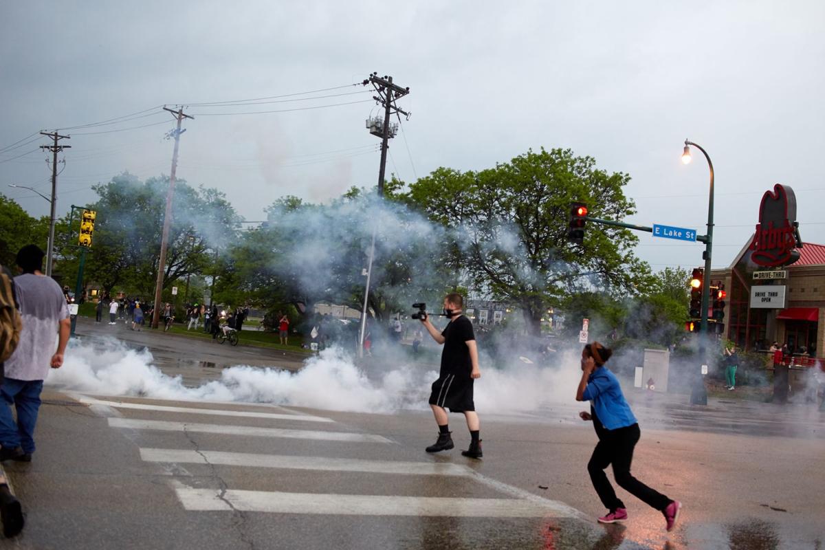 Fractured Skulls Lost Eyes Police Often Break Own Rules Using Rubber Bullets National Insightnews Com