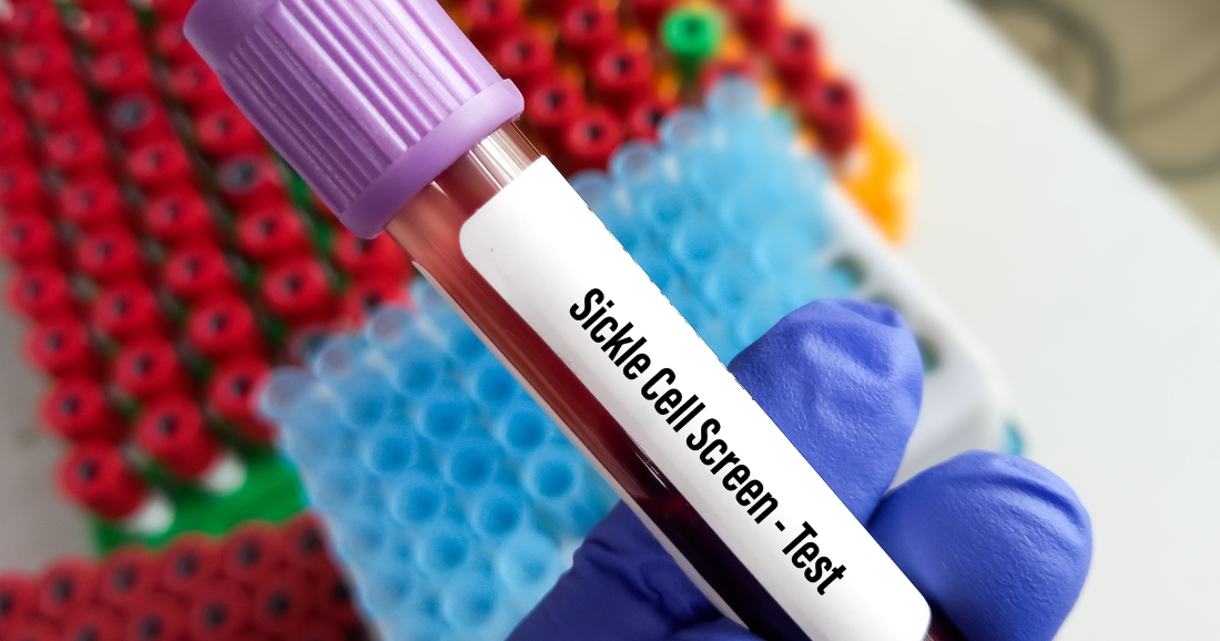 Sickle cell patients ask Florida to close a knowledge gap