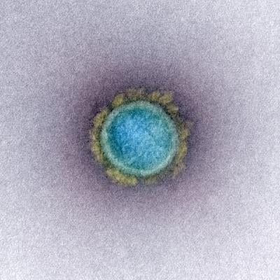 Novel Coronavirus SARS-CoV-2