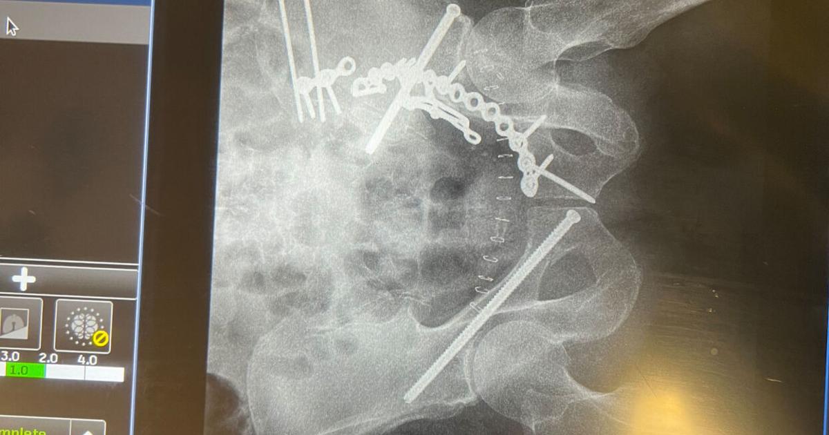 Biker bumps moose rump, breaks pelvis | Environmental | jhnewsandguide.com